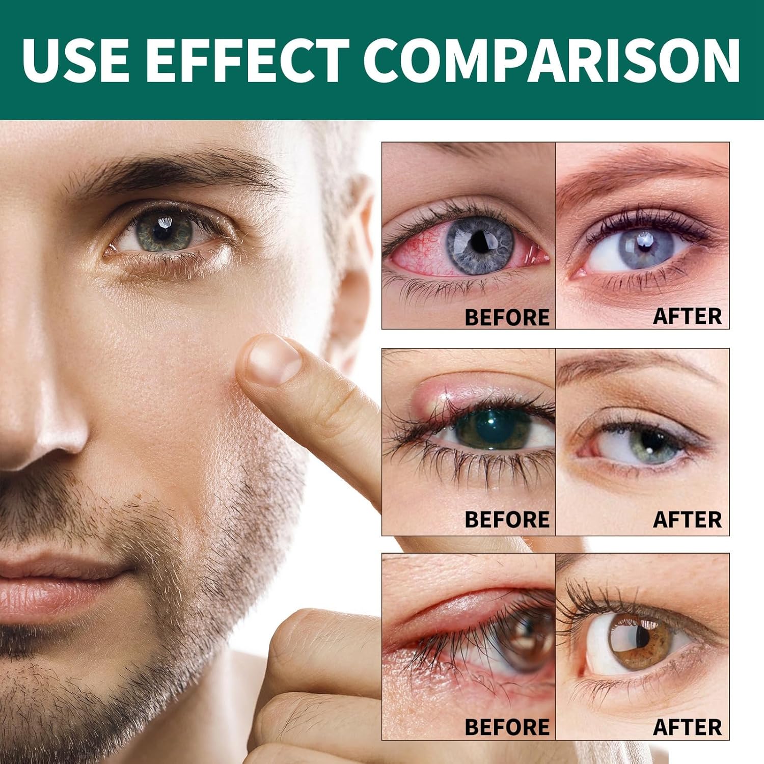 Vision enhance roller